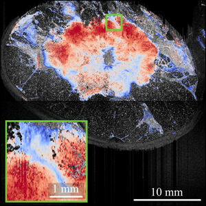 Elastography